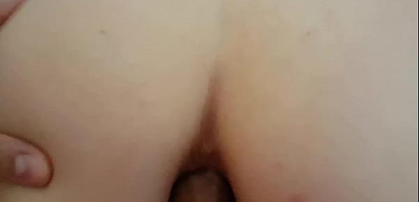  Casal anal
